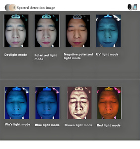 비시아 3600만 화소 피부 분석기 V TWO-S1 3D 스마트 매직 디지털 미러 얼굴 스캐너 피부 분석기 가정용 - Product Image 3