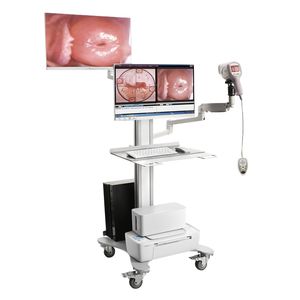 Kernel KN-2200I(H) Full HD 1080P alta definição digital Vídeo Colposcópio para ginecologia vulva exame cervical - Product Image 2