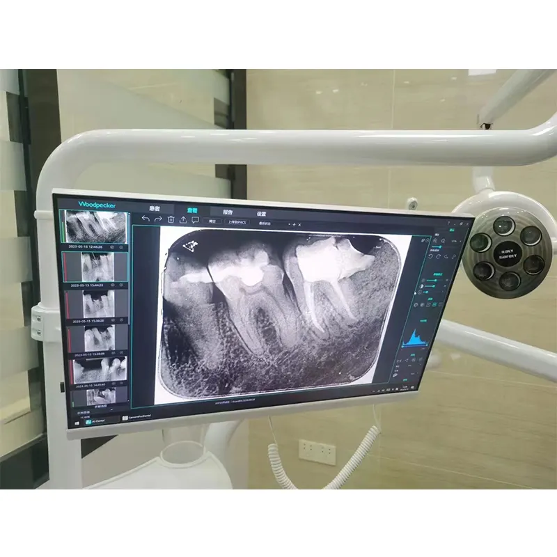 सभी-में-एक कंप्यूटर 24 इंच टच स्क्रीन मॉनिटर के साथ दंत Intraoral कैमरा