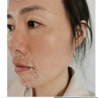 Sérum Professionnel Microneedling Anti-Taches Pigmentaires Bio Peeling Masque Micro-Aiguilles aux Algues Marines