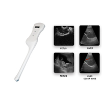 Konted C10QT 3-en-1 Sonde à ultrasons médicale couleur Machine à ultrasons portable pour la gynécologie