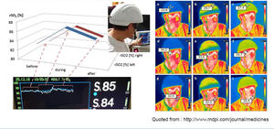 Mesin Terapi Cahaya LED Helm Inframerah Suyzeko 810nm Terapi Neuronic Mesin Fotobiomodulasi 1070nm untuk Terapi Otak - Product Image 4