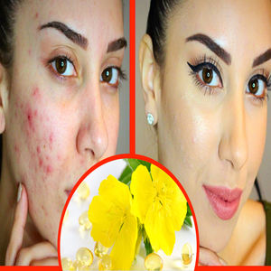 Óleo Transportador Por Atacado Puro Natural Prímula Óleo Essencial Imprensa Fria Óleo De Prímula Preço A Granel para A Pele <span class=keywords><strong>Omega</strong></span> <span class=keywords><strong>3</strong></span> - Product Image 4