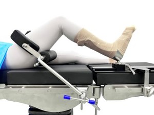 Equipamento Cirúrgico Ortopédico Tabela Operação Acessórios Fixador substituição do joelho - Product Image 5