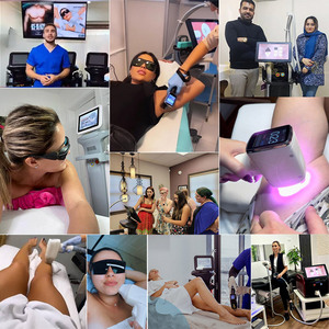 Macchina di epilazione del Laser a diodi 755NM 940NM 1064NM 808nm - Product Image 4