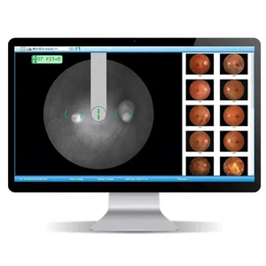 China oftalmal Retina Camera SK-650B Eye Test Camera Retina Fundus Camera - Product Image 5