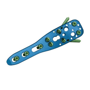 Plaques osseuses chirurgicales orthopédiques manuelles de haute qualité 3,5 mm en acier inoxydable, ciseaux chirurgicaux, kit de chirurgie, fixation osseuse de la colonne vertébrale - Product Image 3