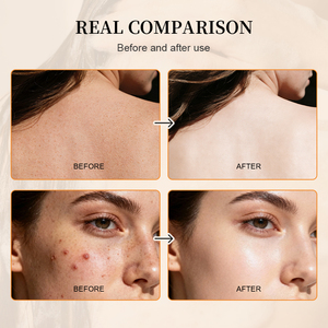 Sapone Solido Artigianale alla Curcuma e Acido Kojico <span class=keywords><strong>per</strong></span> Viso e Corpo, Detergente Antisettico, Sbiancante, Idratante <span class=keywords><strong>per</strong></span> Tutti i Tipi di Pelle - Product Image 3