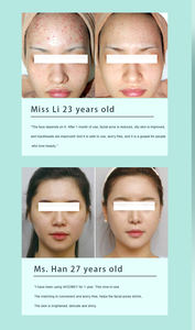 Appareil professionnel 8-en-1 de dermabrasion aquatique et oxygénation pour le visage et les yeux, machine de rajeunissement cutané à bulles d'oxygène pour salon et SPA - Product Image 2