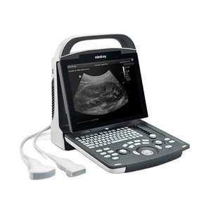 Appareil d'échographie vétérinaire Mindray de bonne qualité, portable, pliable, scanner d'échographie vétérinaire pour ordinateur portable, équipement médical hospitalier - Product Image 1