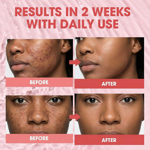Sérum Facial AFCARE PDRN com Complexo de DNA de Salmão e Ácido Hialurônico Hidratante Firmador para Pele Saudável - Product Image 5