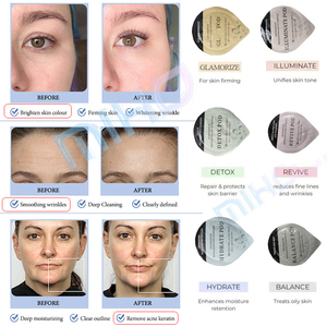 Mới nhất màu đen oxy Mặt x Máy trẻ hóa da oxy glow2 thiết bị trên khuôn mặt - Product Image 5