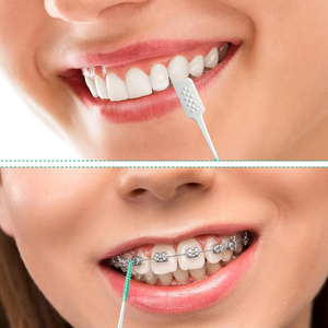 40 cepillos interdentales en bolsa de plástico para limpieza dental ortodóntica, cuidado bucal, cerdas de silicona para eliminar la placa - Product Image 6