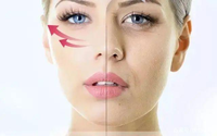 Machine de liposuccion au laser diode 980 nm + 1470 nm, élimination de la graisse, endolaser, lifting du visage