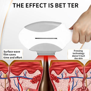 Huanshi Mesin <span class=keywords><strong>Laser</strong></span> OPT Elight <span class=keywords><strong>IPL</strong></span> Multifungsi untuk Menghilangkan Rambut Peremajaan Kulit Terapi Pigmentasi Jerawat - Product Image 4