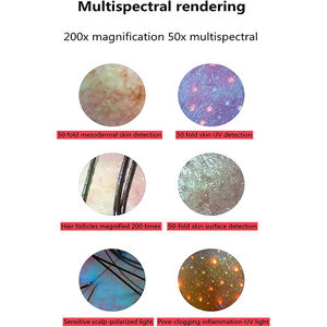 Analyseur de cheveux numérique de 11 pouces avec 4 analyses de perspective spectrale Grossissement 50X-200X Soins de la peau à domicile Utilisation du cuir chevelu - Product Image 5