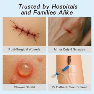 Almohadillas <span class=keywords><strong>de</strong></span> gasa envueltas individualmente, almohadilla antiadherente en el <span class=keywords><strong>centro</strong></span> con borde adhesivo, vendas para heridas, primeros auxilios - Product Image 5