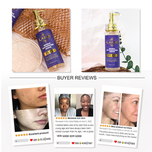 Suero antipigmento de vitamina C de etiqueta privada de alta calidad, blanqueador hidratante, ácido azelaico, hamamelis para eliminar arrugas en la piel - Product Image 4