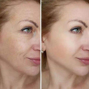 Bálsamo Multiusos de Calcio Cementrete 2026, Ligero, No Grasoso, Iluminador, Cuidado de los Ojos, Vitamina E, Antiarrugas, Reafirmante, Hidratante - Product Image 5