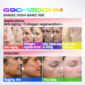 Máquina de Rejuvenecimiento Facial y Corporal BBL <span class=keywords><strong>Plus</strong></span> de Larga Duración, Instrumento Reafirmante Antienvejecimiento de Doble Uso - Product Image 5