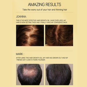 <strong>Biotin</strong> <strong>Hair</strong> Growth <strong>Oil</strong> Fast <strong>Hair</strong> Regrowth Serum Organic <strong>Hair</strong> Growth <strong>Oil</strong> - Product Image 6