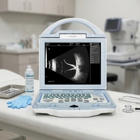 Équipement d'échographie Doppler AB ophtalmique pour hôpital, haute résolution, garantie 1 an, diagnostic intra-oculaire ROBIN ODU5