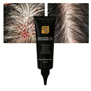 Après-shampoing Naturel Marque Blanche Soin <span class=keywords><strong>Anti</strong></span>-acariens du Cuir Chevelu Essence Moussante Quotidienne - Product Image 1
