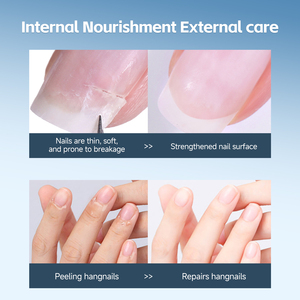 <span class=keywords><strong>Esmalte</strong></span> Fortalecedor <span class=keywords><strong>de</strong></span> <span class=keywords><strong>Uñas</strong></span> LIFE GIRLS, Tratamiento para el Crecimiento, Reparación <span class=keywords><strong>de</strong></span> Cutículas Dañadas, Capa Base <span class=keywords><strong>de</strong></span> Larga Duración, Aceite para el Cuidado <span class=keywords><strong>de</strong></span> las <span class=keywords><strong>Uñas</strong></span> - Product Image 5