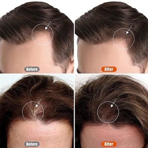 Shampoo au gingembre pour cheveux grisonnants, shampooing pour le soin du cuir chevelu sec et irrité, extrait d'huile de gingembre, formule fortifiante pour les cheveux, pour hommes et femmes - Product Image 5