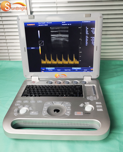 Doppler pulse wave 15 inci Pemasok perangkat medis <span class=keywords><strong>ultrasound</strong></span> 3D rumah sakit - Product Image 2