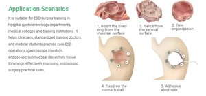 Maniquí de Entrenamiento para Cirugía de Gastroscopia ESD, Modelo de Estómago de Tamaño Real, Material de PVC Avanzado, Fantoma de Ultrasonido de Alta Calidad para - Product Image 5