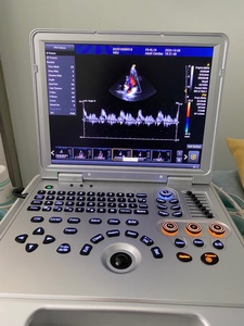 Ecógrafo Doppler Color Portátil de Alto Rendimiento Dawei DW-L3, Diseño Tipo Laptop para Diagnóstico en Hospitales Primarios - Product Image 3