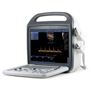 Mesin pemindai <span class=keywords><strong>Ultrasound</strong></span> medis dokter hewan, mesin <span class=keywords><strong>Ultrasound</strong></span> Doppler warna layar 15 "dengan 2 Probe - Product Image 1