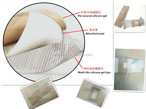 OEM Balutan Luka Balutan Busa Silikon Berbagai Ukuran Grosir Lapisan Kontak Balutan Busa Silikon Menyembuhkan dan Merawat - Product Image 3