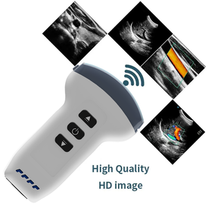 Draagbare draadloze echografie-apparaat voor medisch onderzoek - Product Image 1