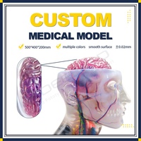 Modèles médicaux personnalisés Stratasys PolyJet Service d'impression 3D couleur pour la planification préopératoire et les affichages d'enseignement