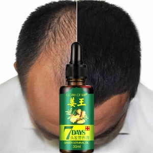 Cuidado del cabello Crecimiento Jengibre Aceite capilar Tratamiento anticaída Aceite esencial Hombres y mujeres 30ml - Product Image 1