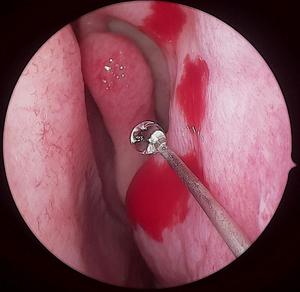 HD portatile della macchina fotografica di sistema/HD Portatile endoscopia sistema di telecamere per la chirurgia veterinaria - Product Image 5