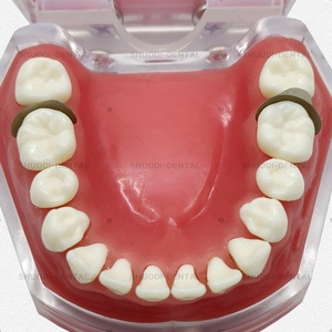 20 pz/pacco di matrice dentale a matrice Tofflemire bande S/M/L matrici sagomate sezionali con blocchi di consumo dentale - Product Image 5