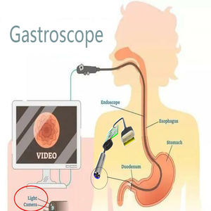 Instrumentos Quirúrgicos para Oídos, Ojos, Nariz y Garganta, Cámara Pequeña Modelo 46, Interfaz USB, 30 FPS, Endoscopio de Acero - Product Image 2
