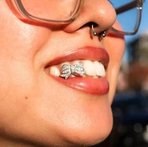Elegantes Grillz Personalizados de Plata de Ley 925 con Moissanita, Joyería Dental con Corte Brillante Tipo Diamante para Moda y Fiestas - Product Image 3