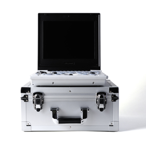 Hệ thống siêu âm di động đa năng dựa trên máy tính xách tay dành cho phòng khám thú y chó/thú cưng-Hỗ trợ hình ảnh 256 cấp độ xám Chế độ B/M - Product Image 5