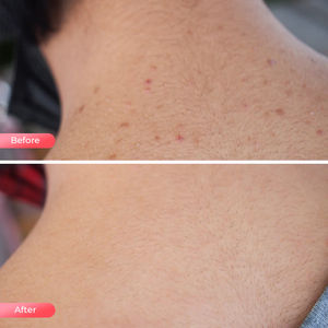 Venta caliente terapia de luz roja para cuello y escote 633 + 830nm uso doméstico máscara de cuello LED de silicona para blanquear la eliminación de arrugas - Product Image 5