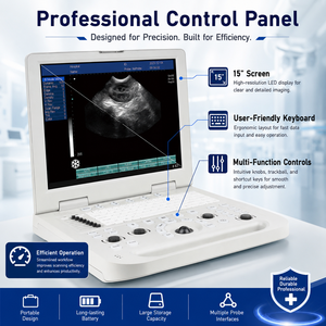 Appareil d'échographie portable avec écran LED HD <span class=keywords><strong>de</strong></span> 15 pouces, scanner <span class=keywords><strong>de</strong></span> diagnostic vétérinaire avec deux ports pour sondes, stockage <span class=keywords><strong>de</strong></span> 16 Go, 4,2 kg - Product Image 5