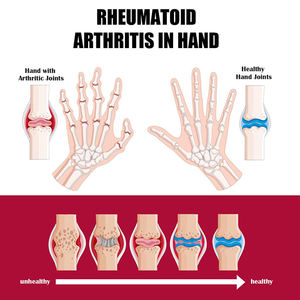 Grosir 50g urat rusak memperbaiki sempurna konsentrat intensif krim sendi dan menenangkan tulang - Product Image 5