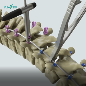ชุดเครื่องมือฝังรากฟันเทียมกระดูกสันหลังแบบแผ่นไทเทเนียมบริเวณกระดูกสันหลังส่วนคอพร้อมสกรูปรับมุมได้ - Product Image 6