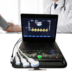 Ecógrafo Doppler Modo B Fácil de Usar con Almacenamiento para Control de Gestación en Animales de Granja y Demanda de Compras al por Mayor Diarias - Product Image 1