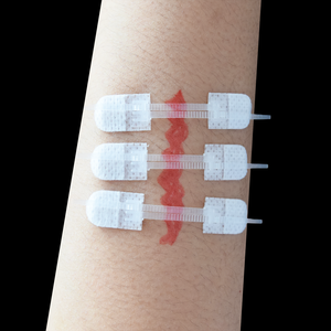 Noodwondverzorging Sluitingen Band Hulp Zip Reparatie Zonder Hechtingen Hecht Kleefband Voor Eerste Hulp - Product Image 4