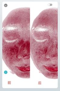 Système d'<span class=keywords><strong>analyse</strong></span> cutanée IA avec écran tactile Android de 21,5 pouces et détection de lumière UV RGB pour l'<span class=keywords><strong>analyse</strong></span> des pores, des rides et de l'acné - Product Image 4