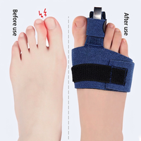 Marteau de redressement d'orteils portable, léger, en alliage d'aluminium bleu, avec tissu composite en éponge respirant et réglable – Meilleure vente